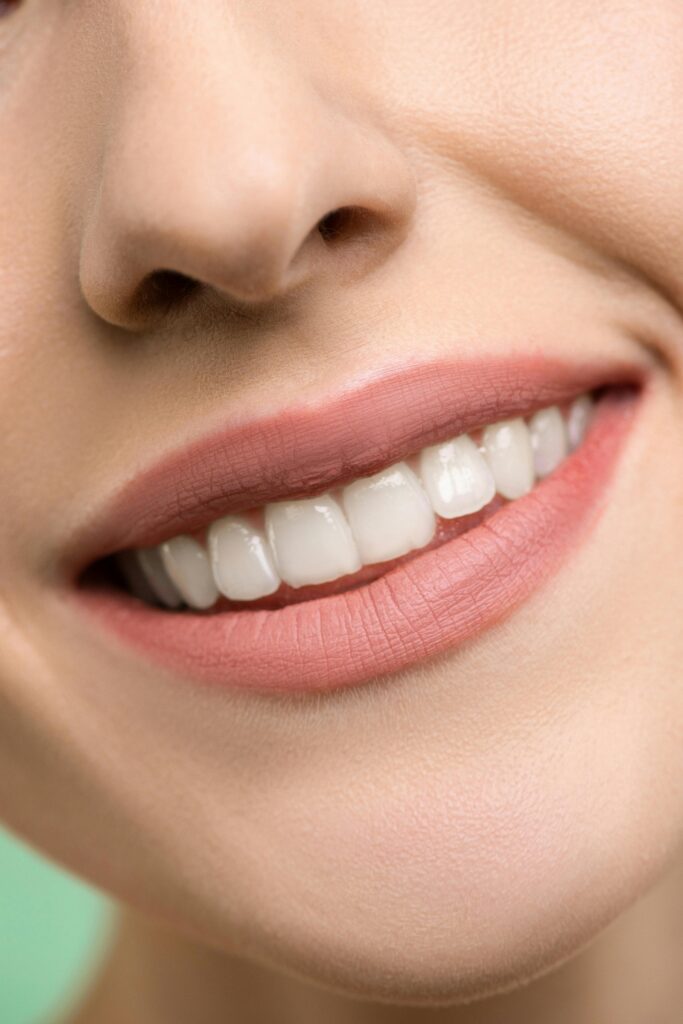 pexels photo 3762441 3762441 A close-up image focusing on a woman's smiling mouth, showing white teeth and pink lips.